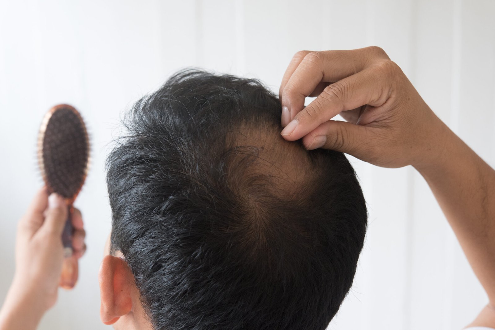 Hair restoration treatment