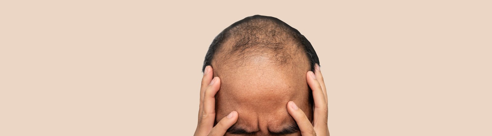 Hairastaderm hair care consultation